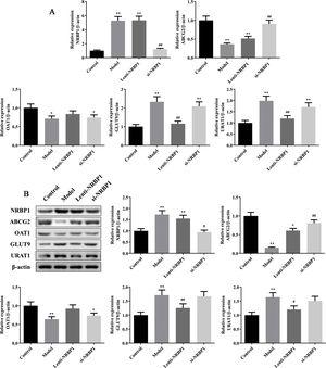 Effect of NRBP1 overexpression and knockdown on the secretion and reabsorption of uric acid. A, Effect of NRBP1 overexpression and knockdown on the mRNA expression of NRBP1, ABCG2, OAT1, GLUT9 and URAT1. B, Effect of NRBP1 overexpression and knockdown on the protein expression of NRBP1, ABCG2, OAT1, GLUT9 and URAT1. (χ¯±s,n=3), *P<0.05, **P<0.01 vs. Control group, #P<0.05, ##P<0.01 vs. Model group.