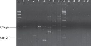 Produse PCR cu inițiatorul RAPD A18 pe gelul de agaroză 1%. Lanes 1 și 10: markeri; Lanes 2-4: Lyco 1, 4 și 5; Lanes 5 și 6: Asef 512 și 1884; Lane 7: ATCC 32865; Lanes 8 și 9 martori (Z. Radicans și C. Agavicola); Lane 11-15: Personalul 4: 004, Personalul 15: 008, Personalul 10: 027, Personalul 1: 037, Personalul 04: 427.