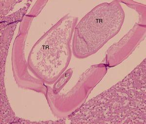 Mayor aumento de la figura 1. I: intestino; TR: tubos reproductivos.