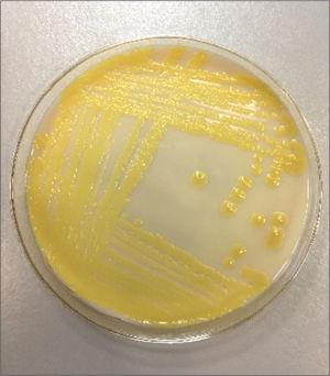 Colonies of Arthrobacter creatinolyticus grown in UTI® chromogenic agar.