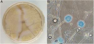 A) Colonias en agar Sabouraud-cloranfenicol incubado durante 72h a 30°C. B) Fialoconidias teñidas con azul de lactofenol (×40).
