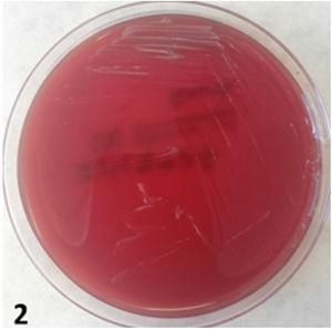 Crecimiento de Brucella spp. en agar sangre Columbia+5% sangre de cordero.