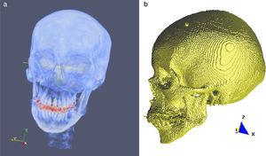 Vistas volumétrica del modelo del cráneo. (a) Vista del volumen original en ParaView. (b) Vista de la superficie del cráneo en GiD.
