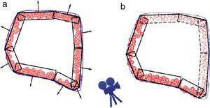 Orientación de las regiones en la corteza del empaquetamiento en 2D. a) Asociación de normales a sectores de la corteza en función de su correspondencia con la superficie. b) Selección de las esferas visibles a partir de la posición de la cámara.