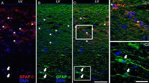 La GFAPα (en la imagen en verde) y la GFAP-δ (en la imagen en rojo) son isoformas de la proteína GFAP. La isoforma α se expresa en todos los astrocitos, es el marcador clásico para su identificación por técnicas de inmunohistoquímica (B, c2) y la isoforma δ solo se expresa en poblaciones de astrocitos, las que están estrechamente ligadas a nichos neurogénicos como es la SVZ (A, c1). En la imagen se muestran imágenes de microscopia confocal donde se observan las 2 isoformas en la SVZ humana, donde en C y c1 podemos ver la colocalización de la GFAP-α y δ (asteriscos), y en c2 solo la expresión de GFAP-α (flechas). Barras A-C: 75micras; c1 y c2: 25micras.