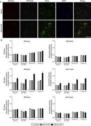 Expressió de panAKT (AKTpan) i fosfoAKT (AKTfosfo) en diverses regions de el sistema nerviós central dels 3 grups de rates. A) Imatges de microscòpia confocal de l'expressió de panAKT, fosfoAKT i periferina (PERIP). B) Anàlisi de fosfoAKT i panAKT de quantificació de densitats òptiques. Es van observar majors expressions de AKTpan i fosfoAKT als 45días en el grup de Cela-LCR (A i B). Un fenomen interessant en el grup de Cela-LCR va ser l'increment en l'expressió de periferina, fosfoAKT i panAKT a les neurones (A). En el dia 82 després de la cirurgia, les concentracions de AKT (pa i fosfo) van ser similars als dels grups sham i no ELA-LCR, l'expressió s'havia tornat a nivells similars als observats en els altres grups als 82días de la cirurgia dies post (B). Escala: 50μm.