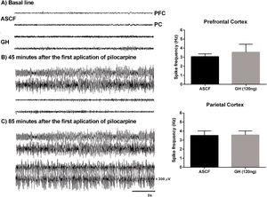 Effect of growth hormone (GH, 120ng) on electrographic activity recorded from Prefrontal (PFC) and Parietal (PC) cortex during the status epilepticus (SE) induced by lithium–pilocarpine. (A) Basal line, (B) Electrographic activity 45min after the first application of pilocarpine (the rat injected with artificial cerebrospinal fluid [ACSF] is already in SE), (C) Electrographic activity 85min after the first application of pilocarpine (at this time, both rats have electrographic and behavioral SE). Graphs on the right panel show the spike frequency during the first generalized electrographic seizure recorded in the PFC and PC after the injection of ACSF or GH. Data are expressed as the mean±S.E.M. and were analyzed by a Student's t-test. No differences were identified between experimental groups. Scale bars: 5s (horizontal) and 300μV (vertical).