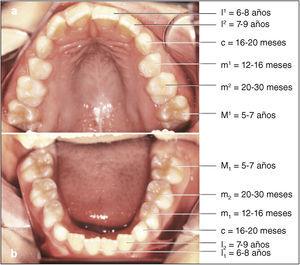 Dentición mixta en el maxilar (a) y la mandíbula (b) y cronología de la erupción de los dientes. Los dientes del sector anterior muestran un ligero apiñamiento. Los dientes temporales en la zona de soporte (caninos y molares temporales) ocupan un espacio en la arcada dentaria que mide aproximadamente 1,5 a 2 mm más que los dientes permanentes correspondientes. Es imprescindible mantener este espacio (Leeway space) para compensar el apiñamiento en el sector anterior. Los dientes temporales se identifican con letras minúsculas y los dientes permanentes con letras mayúsculas. De Radlansky37.
