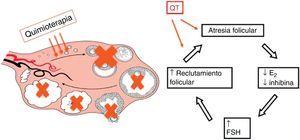 Efectos de la quimioterapia en el ovario.