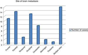Distribution of brain metastasis within different brain regions.