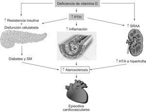 Deficiencia de vitamina D: posibles mecanismos del aumento del riesgo cardiovascular. HTA: hipertensión arterial; PTH: hormona paratiroidea; SM: síndrome metabólico; SRAA: sistema renina-angiotensina-aldosterona.