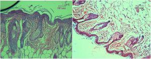 The skin histology of hair loss mice (left) and mice that did not have hair loss (right) with 100× magnification.