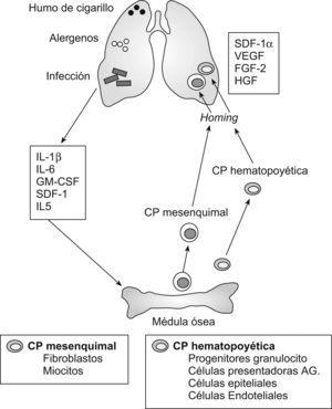 Diagrama que resume cómo la inflamación pulmonar inducida por estímulos de muy diversa naturaleza genera mediadores que provocan en la médula ósea la producción de células progenitoras (CP) hematopoyéticas y mesenquimales implicadas en la regulación de la respuesta inflamatoria. FGF: factor de crecimiento de los fibroblastos; GM-CSF: factor estimulante de las colonias de granulocitos y macrófagos; HGF: factor de crecimiento de los hepatocitos; IL: interleucina; SDF: factor derivado de la estroma; VEGF: factor de crecimiento del endotelio vascular. (Modificada de Denburg y Van Eeden53.)
