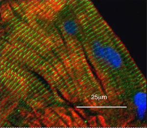 Imagen con microscopio de campo ancho de un corte longitudinal de músculo cuádriceps de un individuo control, sano, demostrándose la localización de YY1 en relación con los núcleos musculares mediante inmunohistoquímica. El músculo se tiñó para YY1 (verde), la cadena pesada de la miosina rápida (rojo) y los núcleos utilizando 4’,6-diamidino-2-fenilindol (azul). Se observa la tinción de YY1 a lo largo de los sarcómeros, no colocalizada con la miosina, y la ausencia de los núcleos.