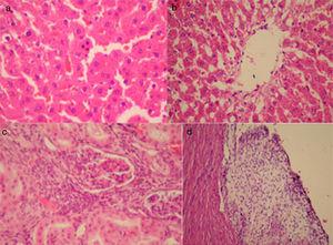 (a) Pyknotic nuclei in hepatocytes in Group-C (HE×400); (b) sinusoidal dilatation of liver tissue in Group-C (HE×400); (c) glomerular degeneration of kidney tissue in Group-C (HE×400); (d) pericarditis in pericardium in Group-C (HE×400).