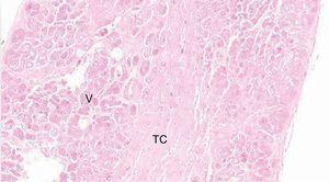 Tinción de hematoxilina-eosina de falso tendón del ventrículo izquierdo a 10 aumentos que muestra tejido conectivo en zona central y muscular. También es visible la presencia de vascularización. TC: tejido conectivo; V: vascularización.