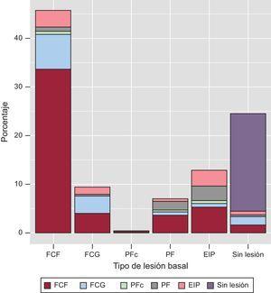 Transiciones del fenotipo de placa (eje x) entre la evaluación basal y la de seguimiento (los fenotipos de placa se indican mediante códigos de color). EIP: engrosamiento intimal patológico; FCF: fibroateroma de capa fina; FCG: fibroateroma de capa gruesa; PF: placa fibrosa; PFc: placa fibrocalcificada.