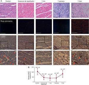 Dinámica de la densidad microvascular en un modelo porcino del infarto de miocardio reperfundido. A: imágenes representativas del tejido infartado aislado del grupo control y de los 4 grupos de infarto de miocardio (sin reperfusión, 1min, 1 semana y 1 mes tras la reperfusión) con tinción con hematoxilina-eosina (paneles superiores), rojo picrosirio (paneles centrales) y con el marcador vascular específico CD31 (paneles inferiores); las flechas rojas indican los vasos CD31+; la barra de escala indica 100 μm. B: cuantificación de los vasos con CD31+. Las imágenes del área infartada aislada de los 5 grupos independientes se analizaron con el programa informático de análisis Image-Pro Plus; el número de vasos CD31+ se redujo en el miocardio infartado de los grupos sin reperfusión y de 1min y de 1 semana de reperfusión, en comparación con los controles, y se recuperó 1 mes después de la reperfusión; los datos (media ± desviación estándar; n ≥ 5) se analizaron con un ANOVA de una vía seguido de una prueba de Bonferroni; un evaluador que no conocía el grupo experimental del que procedían realizó la evaluación. HE: hematoxilina-eosina. ap < 0,05 frente al control. bp < 0,05 frente al grupo de 1 semana de reperfusión. Esta figura se muestra a todo color solo en la versión electrónica del artículo.