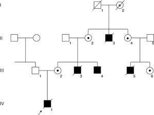 Árbol genealógico de la familia. Los cuadrados y los círculos indican familiares de sexo masculino y femenino, respectivamente. Los familiares afectados se indican en negro y los fallecidos, con una raya cruzada. Una flecha indica al paciente índice (IV-1). La mutación del gen FLNA se confirmó en el varón afectado vivo III-4 y las mujeres portadoras II-2, II-4, III-2 y III-6, y se indica con un punto negro. La portadora obligada I-2 se indica con un punto gris.