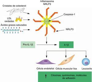 Los lípidos aterogénicos activan el inflamasoma NLRP3 para activar la IL–1β por medio de su procesamiento proteolítico. La transcripción del gen IL1B produce pro-IL-1β, una proteína precursora que carece de actividad biológica y se escinde por la caspasa–1 para generar la forma activa de la IL-1β, que se secreta al espacio extracelular. En la placa ateroesclerótica, la actividad de la caspasa–1 y la escisión de la IL–1β dependen principalmente del inflamasoma NLRP3, que se activa al detectar lípidos aterogénicos, con mayor frecuencia cristales de colesterol. Una vez secretada, la IL–1β induce la expresión de varias citocinas, quimiocinas y moléculas de adhesión, fundamentales para la perpetuación de la inflamación en la placa ateroesclerótica. IL-1β: interleucina 1 beta; LDL: lipoproteínas de baja densidad; NLRP3: dominio pirínico de la familia NLR que consta de 3.