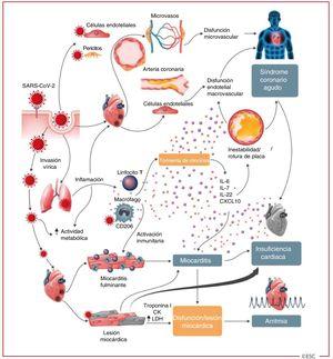 Afectación cardiovascular en la COVID-19: manifestaciones clave y mecanismos hipotéticos. El SARS-CoV-2 se ancla a la enzima de conversión de la angiotensina II transmembranaria para entrar en las células del huésped, como los neumocitos tipo 2 o macrófagos, las células endoteliales, los pericitos y los miocitos cardiacos, con lo que causa inflamación y fallo multiorgánico. La infección de las células endoteliales o los pericitos tiene especial importancia, ya que podría conducir a una disfunción microvascular y macrovascular grave. Además, la hiperreactividad inmunitaria puede desestabilizar las placas de ateroesclerosis, lo cual explicaría la aparición de síndromes coronarios agudos. La infección de las vías respiratorias, en especial los neumocitos de tipo 2, por el SARS-CoV-2 se manifiesta por la progresión de la inflamación sistémica y la hiperreacción de células inmunitarias que conduce a una «tormenta de citocinas» que da lugar a un aumento de la concentración de citocinas como IL-6, IL-7, IL-22 y CXCL10. Luego, es posible que los linfocitos T y los macrófagos activados infiltren el miocardio infectado, lo cual da lugar a la aparición de una miocarditis fulminante y una lesión cardiaca grave. Este proceso puede intensificarse aún más por una tormenta de citocinas. Asimismo la invasión vírica puede causar una lesión de los cardiomiocitos que origine directamente una disfunción del miocardio y contribuya a la aparición de arritmias6. Reproducido de la obra original «ESC Guidance for the Diagnosis and Management of CV Disease during the COVID-19 Pandemic»7. Reproducido con permiso de la © Sociedad Europea de Cardiología 2020. Reservados todos los derechos.