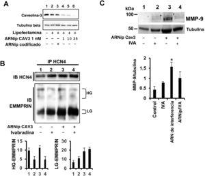 La falta de caveolina-3 altera la formación del complejo EMMPRIN/HCN4. A: inmunoblot de caveolina-3 de células H9c2 transfectadas con lipofectamina (sin ARNip) o ARNip1 de caveolina-3 1, 10 y 25nM. Se utilizó tubulina beta como control negativo. B: panel superior, immunoblot de HCN4 de extractos inmunoprecipitados con HCN4 de células H9c2 silenciadas con siARNi de caveolina-3 10nM; panel inferior, immunoblot de EMMPRIN de los mismos extractos (n=3). C: immunoblot de MMP-9 en células silenciadas con H9c2 incubadas con ivabradina 0,3mg/kg (n=3; media±desviación estándar; *ARNip frente a ARNip + ivabradina, p <0,001). MMP-9: metaloproteinasa de la matriz extracelular 9; siARN: ARN de interferencia. Esta figura se muestra a todo color solo en la versión electrónica del artículo.