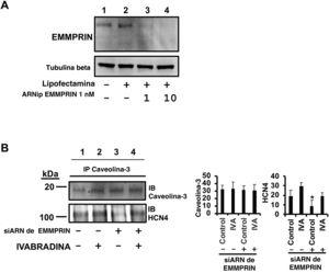 La falta de EMMPRIN altera la formación del complejo caveolina-3/HCN4. A: silenciamiento génico de EMMPRIN con siARN específico de EMMPRIN; Se empleó tubulina beta como control de carga. B: inmunoblot de HCN4 de extractos inmunoprecipitados con anticaveolina-3 de células H9c2 silenciadas con siARN de EMMPRIN 10nM (n=3; media±desviación estándar; *siARN de HCN4 frente a siARN + ivabradina, p <0,004). siARN: ARN de interferencia. Esta figura se muestra a todo color solo en la versión electrónica del artículo.