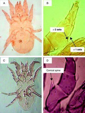 Seasonal population of Acarus siro mites and effects of their faeces on ...