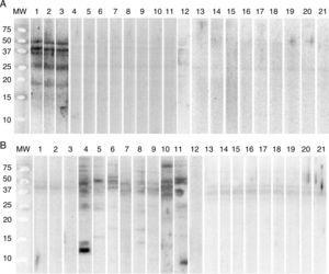 Western blot. (A) Extract of G. gigas transferred to membrane. (B) Extract of A. simplex transferred to membrane. MW, Marker of molecular weight. Lanes 1–3: patients positive to G. gigas. Lanes 4–12: patients positive to A. simplex. Lanes 13–21: Negative controls.