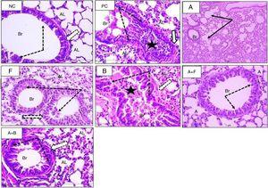 Subdiuretic Dose Of Furosemide Enhances Albuterol Effects In Asthmatic Mice Rather Than Bumetanide Allergologia Et Immunopathologia