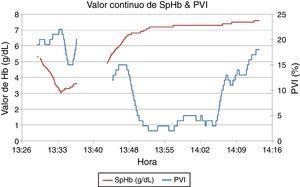 Representación gráfica de los valores continuos de SpHb y PVI reflejados por el cooxímetro Radical 7® a lo largo de la intervención. Fuente: autores.