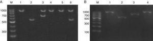 (A) Electrophoresis of the hwp1 gene PCR using DNA pools resolved on 1% agarose gel. Lane M, 100bp size marker. Lane 1, C. albicans control strain (ATCC 90028). Lane 2, C. dubliniensis control strain (NCPF 3949). Lanes 3–6, DNA pools showing hwp1 bands. Lane 3: 941bp and 700bp (C. albicans and C. africana). Lanes 4 and 5: 941bp (C. albicans alone). Lane 6: 941 and 569bp (C. albicans and C. dubliniensis). (B) Electrophoresis on 1% agarose gel of the hwp1 PCR using individual DNAs (from the DNA pool displayed in lane 3 – (A)). Lane M, 100bp size marker. Lane 1, C. albicans control strain (ATCC 90028). Lane 2, C. dubliniensis control strain (NCPF 3949). Lane 3, C. africana (Strain LMDM 678). Lane 4, C. albicans (Strain LMDM 679).