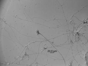 Conidia and phialides of Purpureocillium lilacinum.