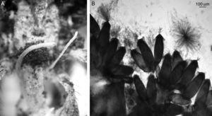 O. caloceorides. (A) S. platense showing fungal stroma of O. caloceorides. (B) Details of asci of O. caloceorides.