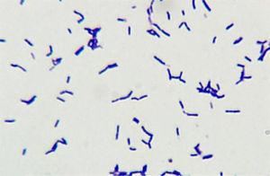 Coloración de Gram de Bifidobacterium scardovii en caldo tioglicolato, aumento 1.000×. Se observan bacilos gram positivos irregulares, algunos ramificados, curvados y con extremos bifurcados en forma de Y.