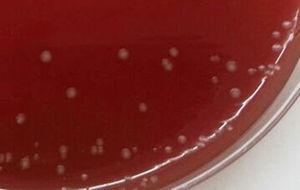 Placa de agar Brucella suplementado con colonias transparentes, γ-hemolíticas, de 2mm de diámetro. Incubación en anaerobiosis 72 h.