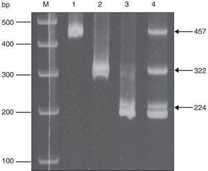 HPV typing by multiplex PCR. The result of a sample with multiple infections is shown. (M) Size markers, (1) HPV16 positive control, (2) HPV18 positive control, (3) HPV58 positive control, (4) sample with a co-infection with HPV16, HPV18 and HPV58. Arrows indicate the fragment size.