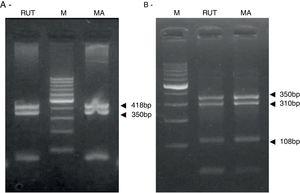 Helicobacter pylori clarithromicyn resistance analysis by PCR-RFLP. Amplicons (768bp) from mutant strains were digested with MboII (A) and BsaI (B). M, molecular size marker (Cien Marker, Biodynamics, Buenos Aires, Argentina).