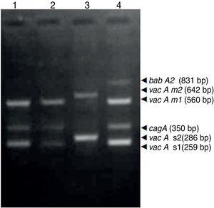 Multiplex PCR for Helicobacter pylori virulence factors. Lanes: (1) cagA(+)/vacAs1m1/babA2(−) genotype, (2) cagA(+)/vacAs1m1/babA2 (−) genotype, (3) cagA(−)/vacAs2m2/babA2(−) genotype, (4) cagA (+)/vacA s1m1/babA2(+) genotype.