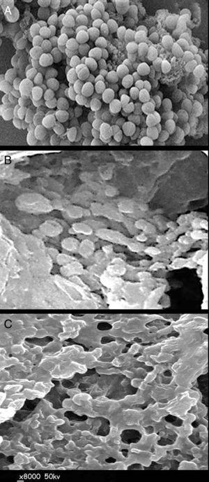 Scanning electron micrographs of treated Staphylococcus aureus cells with Quercus infectoria extract after different exposure times. (A) Control, (B) after 3h and (C) after 6h.