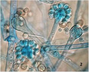 Esporangióforos rectos con vesículas y esporangiolos. Tinción de lactofenol con azul de algodón. 100×.