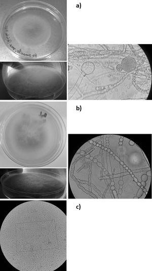 Aspecto de los microorganismos contaminantes de muestras de yogur alteradas. Observación macroscópica de la colonia (izquierda) y microscópica (100x) de contraste de fases (derecha) de los mohos Mucor racemosus (a) y Mucor circinelloides (b) en agar YGC a los 2 y 5 días de incubación a 28°C; observación microscópica (100x) de contraste de fases de Gluconobacter sp. (c).