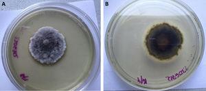 Scedosporium aurantiacum. Sabouraud glucose agar. A. Front view. B. Reverse view.