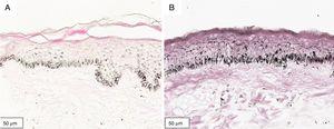 Histological section of organoid culture (72h) of retroauricular skin (Fontana-Masson, ×400). (A) Culture not irradiated; (B) culture irradiated with UVA, 1.524J/cm2.