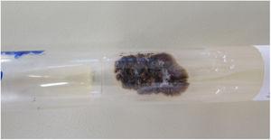 Fungal culture at 25°C showing a blackish filamentous colony with whitish areas. Colony growth after seven days.
