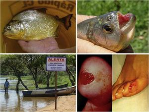 River resort (municipality of Adolfo-SP, 21°09'56"S, 49°43'03"W) at a reservoir area of the Tietê River. Accidents due to piranha attacks on bathers: punched-out ulcers in the foot. Details of the adult animal and the triangular teeth (Serrasalmus maculatus).