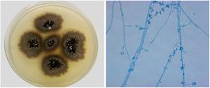 Sporothrix brasiliensis – left, colony macromorphology in the filamentous phase in potato dextrose agar (PDA), after 14 days of incubation at 30 °C. On the right, microscopy of the filamentous phase, stained by cotton blue with lactophenol (× 400).* The experiments of this work were carried out at the Mycology Laboratory of the National Institute of Infectious Diseases Evandro Chagas INI - Fiocruz/RJ.