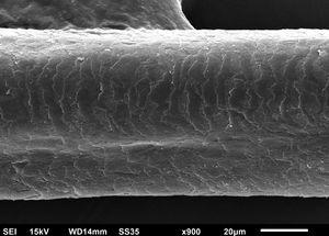 Scanning electron microscopy - Hair examination - large magnification showing slight cuticle disorganization (×900).