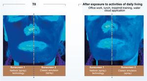 Illustration showing UV radiation absorption capacity of two sunscreens evaluated by photographs taken under UV light. (Source: Moyal et al.31).