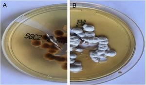 Sabouraud’s Dextrose Agar culture of the first patient. (A), Reverse of colony with a yellow-red color. (B), Front view with white powdery colonies. These aspects are suggestive of T. rubrum.